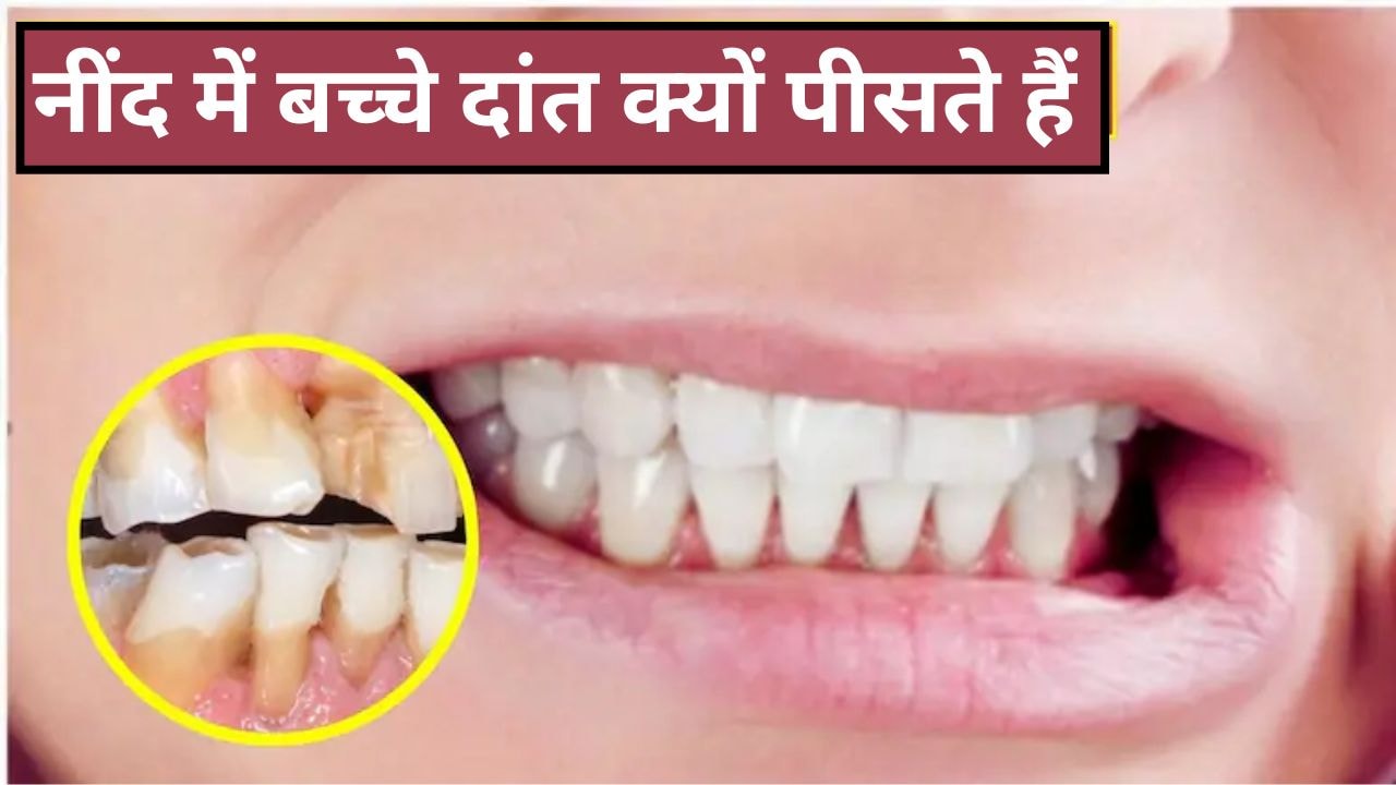 क्या आपका बच्चा रात में दांत पीसता है? पीडियाट्रिशियन ने बताया बच्चा क्यों करता है ऐसा, कैसे छूटेगी ये आदत