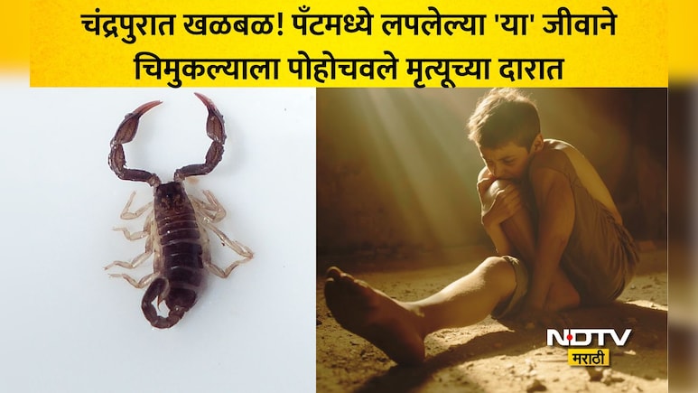 Chandrapur: चंद्रपुरात खळबळ! खुंटीवरची पँट घातली अन् अंग थंड पडलं, 12 वर्षाच्या मुलाची 3 दिवस मृत्यूशी झुंज