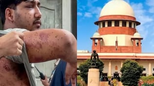 पैलेट गन का इस्तेमाल कब और कैसे हो? सुप्रीम कोर्ट ने कही प्रोटोकॉल तय करने की बात