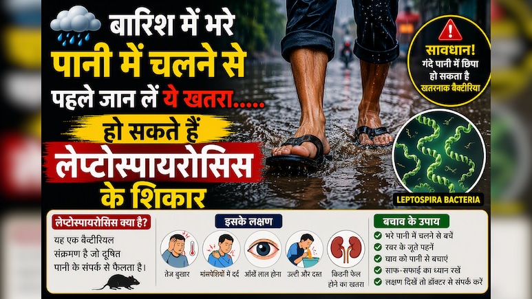 बरसात में पानी भरी सड़क पार करने से पहले जान लें ये खतरा, हो सकते हैं लेप्टोस्पायरोसिस के शिकार
