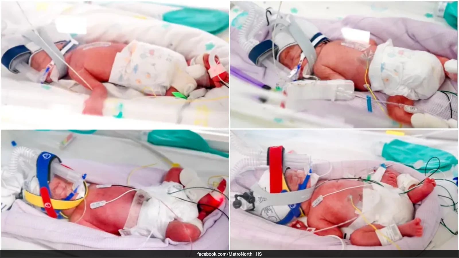 Australian Woman Gives Birth to Quadruplets, Seeks Help for 10-Seater Car