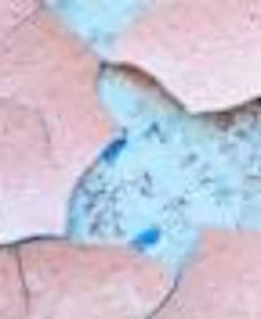 Tips To Prevent Eczema