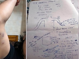 "Shards Stuck To Skin": Hospital Report Shows Pellet Guns Used At CJP Protest