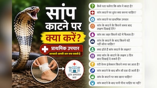 सांप काट ले तो क्या पानी पी सकते हैं? 3 दिन बाद भी दिखते हैं लक्षण! डॉक्टर से जानें तुरंत क्या करें और क्या नह