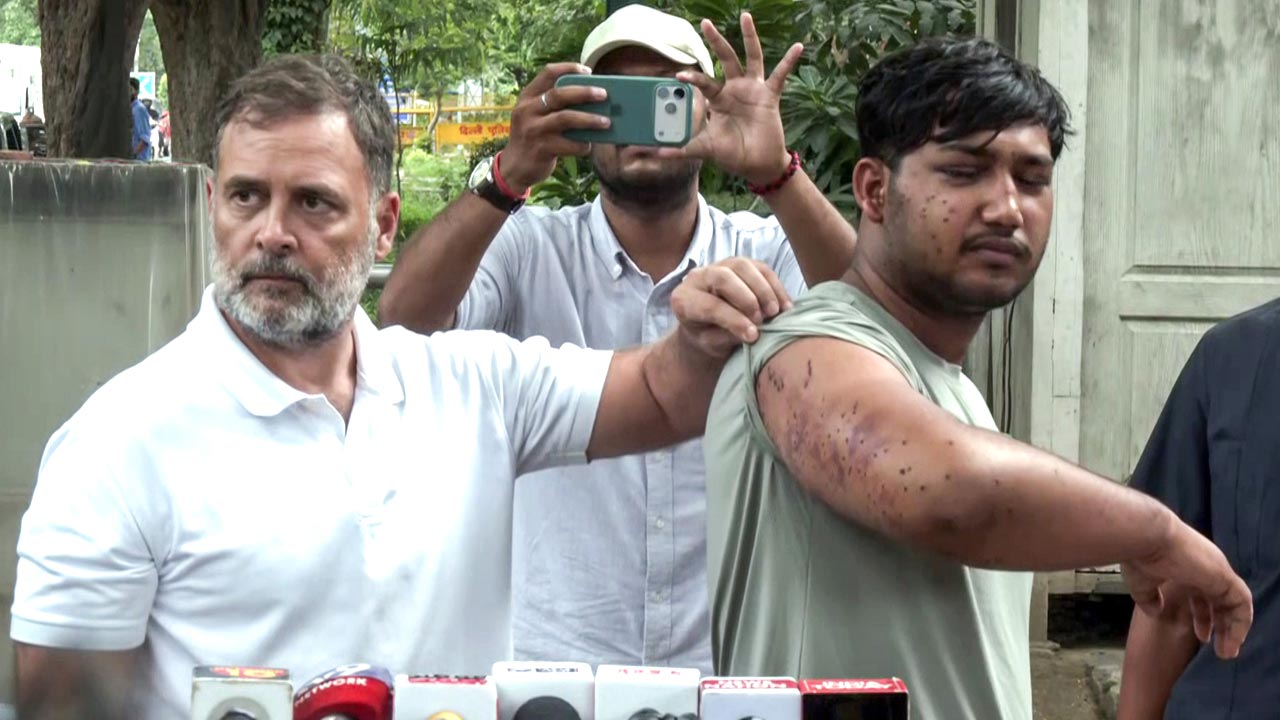 'Students Deserve Justice': Rahul Gandhi Seeks Top Court-Monitored Probe Into Pellet Gun Claims