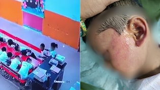 Teacher Not In Room, Class Monitor Thrashes Nursery Student For Raising Head
