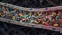 Heart Attack Patients Have More Micro And Nanoplastic In Blood: Study