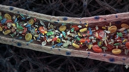 Patients Who Suffer Heart Attack Have More Micro And Nanoplastic In Their Blood: Study