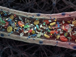 Patients Who Suffer Heart Attack Have More Micro And Nanoplastic In Their Blood: Study