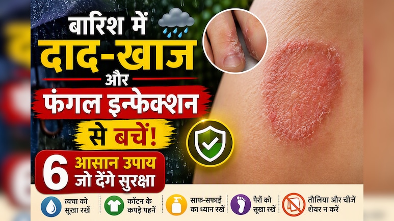 बारिश में दाद, खाज और फंगल इन्फेक्शन से हैं परेशान? इन आसान उपायों से करें बचाव