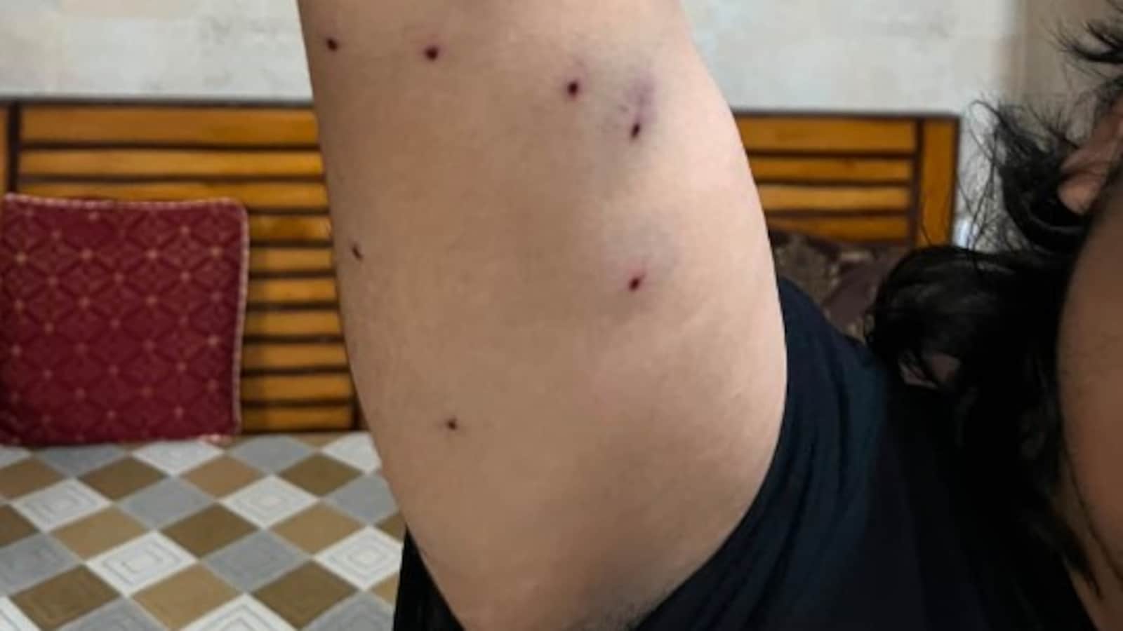 Cops Who Used Pellet Guns On Protesters Identified, CRPF Leads Probes