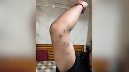 Anti-Riot Cops Who Used Pellet Guns On Protesters Identified, CRPF Probes