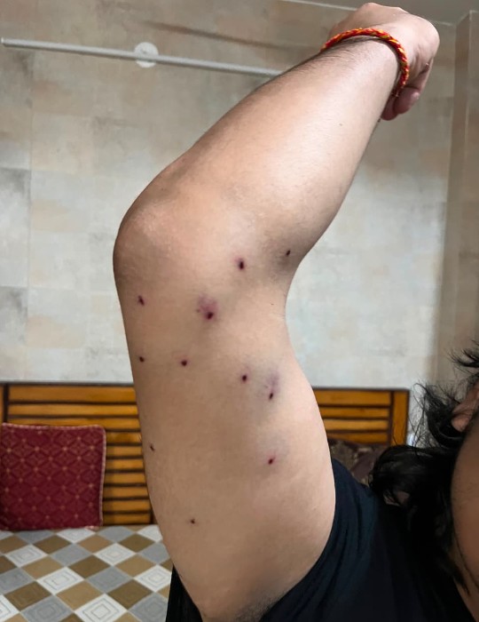 Anti-Riot Cops Who Used Pellet Guns On Protesters Identified, CRPF Probes