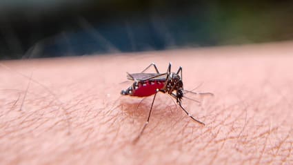 Over 4,500 Dengue Cases In Bengal: Signs You Shouldn't Mistake For Flu