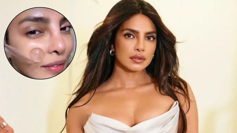 चेहरे पर Gold Serum लगाती हैं Priyanka Chopra, डर्मेटोलॉजिस्ट से जानें क्या होता है ये, किन लोगों के लिए है सबसे अच्छा