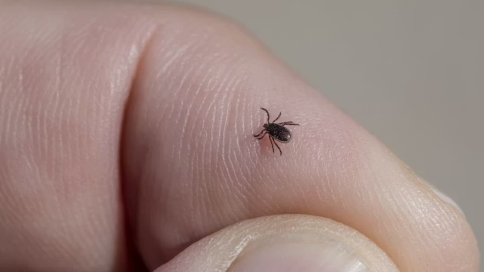 Rare Bourbon Virus Detected in New York Patient