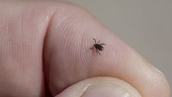 Rare Bourbon Virus In New York: What To Know About The Disease