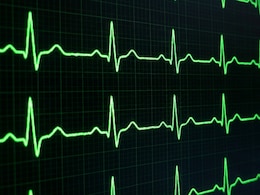 FDA Approves First-Ever AI Tool To Detect Hidden Heart Conditions Before Symptoms Show