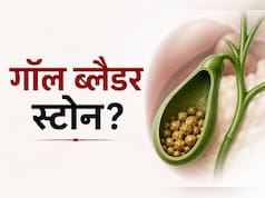 गॉल ब्लैडर स्टोन को भूलकर भी न करें नजरअंदाज, डॉक्टर सरीन ने बताया क्यों?
