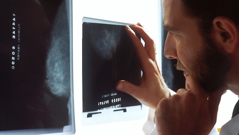 She Was Told Her Mammogram Was 'Clear'. Now, She Has Stage 4 Breast Cancer And A $7 Million Verdict