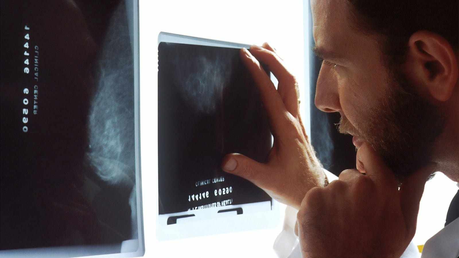 US Woman Was Told Mammogram Was ‘Clear’. Now She Has Stage 4 Breast Cancer And A $7 Million Verdict