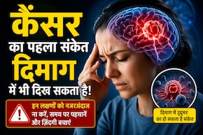 कैंसर का पहला संकेत दिमाग में भी दिख सकता है! डॉक्टर ने बताए Paraneoplastic Syndrome के चेतावनी वाले लक्षण