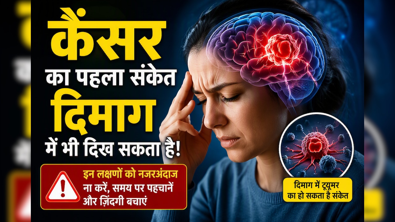 कैंसर का पहला संकेत दिमाग में भी दिख सकता है! डॉक्टर ने बताए Paraneoplastic Syndrome के चेतावनी वाले लक्षण