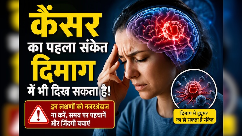 कैंसर का पहला संकेत दिमाग में भी दिख सकता है! डॉक्टर ने बताए Paraneoplastic Syndrome के चेतावनी वाले लक्षण