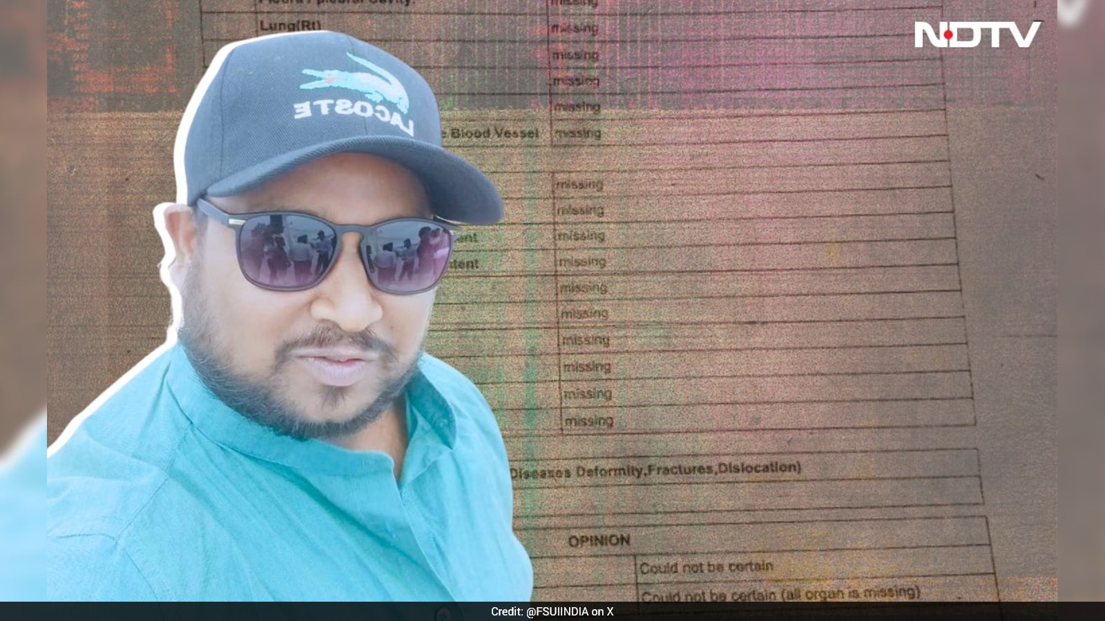 Brain, Heart, Lungs Missing From Indian Sailor’s Body Who Died In Venezuela, Family Demands Probe