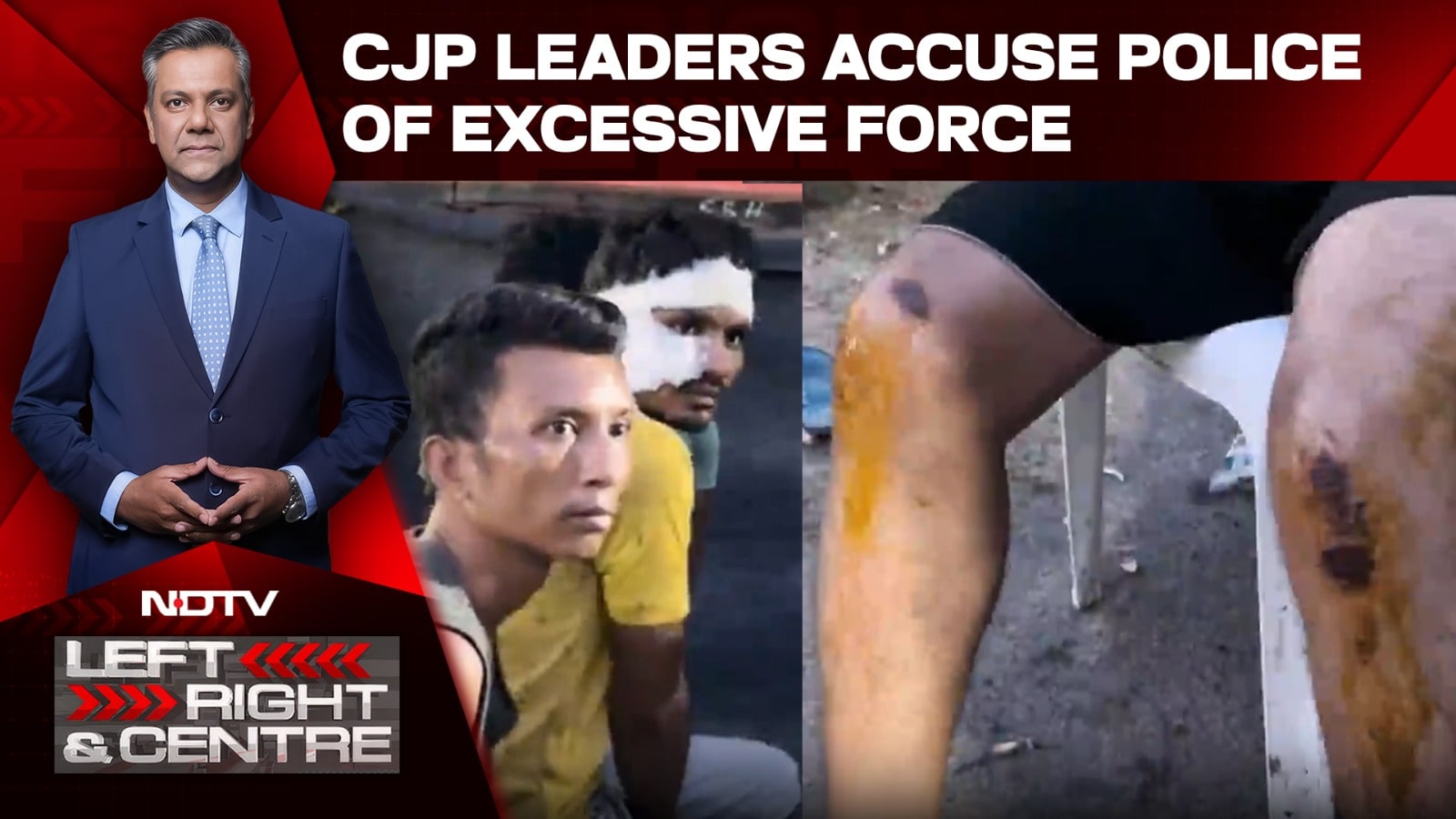 'Look At Their Injuries': CJP Leaders Accuse Police Of Excessive Force