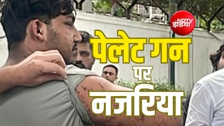 Explainer: पेलेट गन के इस्तेमाल पर क्या कहते हैं संयुक्त राष्ट्र, मानवाधिकार संगठन, कानून और सुप्रीम कोर्ट?