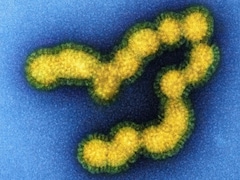 Swine Flu Alert In Nagpur: Cases Rise To 15 In July, One Dead