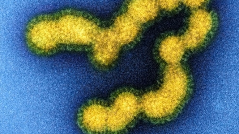 Swine Flu Count Rises In Delhi; 134 New Infections Reported In Last 24 Hours