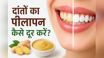 पीले दांतों की सफाई के लिए 5 मिनट का घरेलू उपाय, आयुर्वेदाचार्य ने बताए फायदे