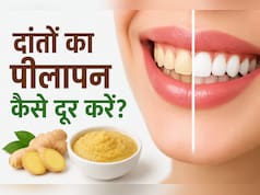 पीले दांतों की सफाई के लिए 5 मिनट का घरेलू उपाय, आयुर्वेदाचार्य ने बताए फायदे