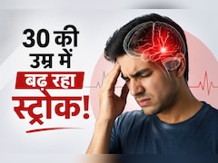 30-40 की उम्र में क्यों बढ़ रहे हैं स्ट्रोक के मामले? न्यूरोलॉजिस्ट प्रवीण गुप्ता ने बताए 7 बड़े कारण