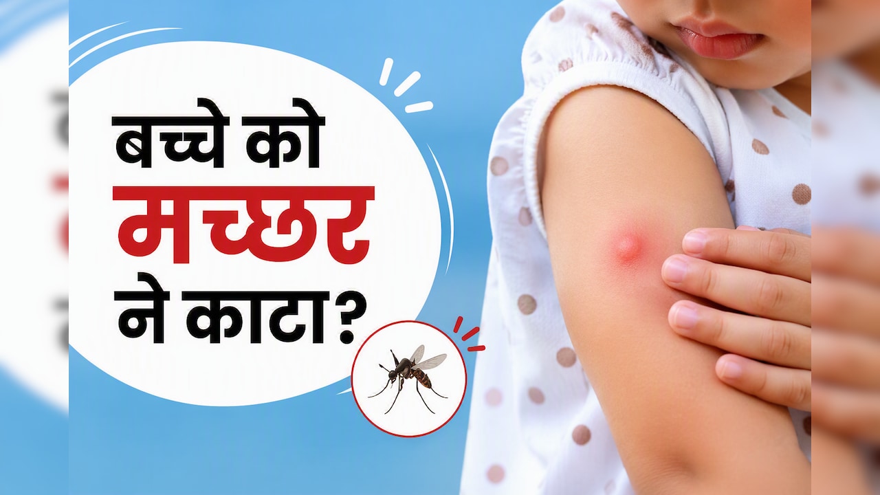 बच्चों को मच्छर काट ले तो क्या लगाना चाहिए? डॉक्टर के बताए ये 3 ट्रिक्स खुजली और जलन से दिलाएंगे आराम