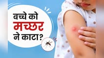 बच्चों को मच्छर काट ले तो क्या लगाना चाहिए? डॉक्टर के बताए ये 3 ट्रिक्स खुजली और जलन से दिलाएंगे आराम