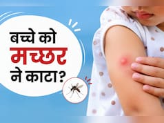 बच्चों को मच्छर काट ले तो क्या लगाना चाहिए? डॉक्टर के बताए ये 3 ट्रिक्स खुजली और जलन से दिलाएंगे आराम