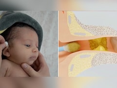 छोटे बच्चे का कान कैसे साफ करें? पीडियाट्रिशियन ने बताई पैरेंट्स के लिए जरूरी बातें