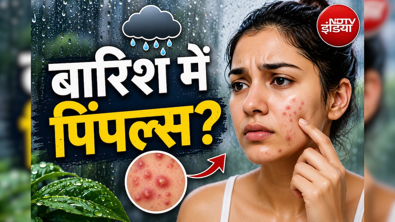 Monsoon Skin Care: बारिश में क्यों निकलते हैं अचानक पिंपल्स? डर्मेटोलॉजिस्ट ने बताए 4 आसान बचाव के तरीके