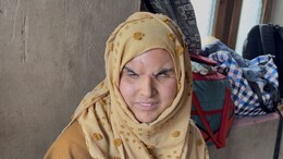 NDTV Impact: J&K Pellet Victim Who Lost Eyesight In 2016 Gets Compensation