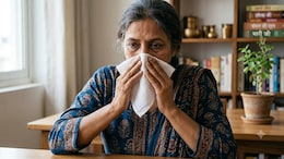 Frequent Nosebleeds? Doctor Explains The Causes And Prevention