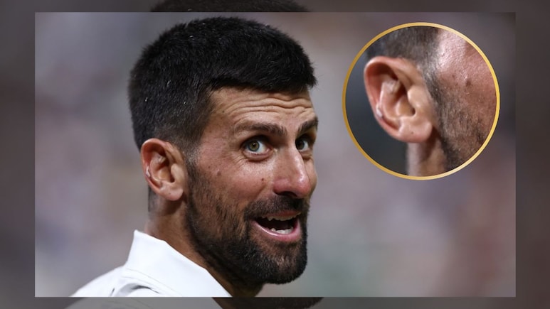 Novak Djokovic's Ear-Seeding Pics Go Viral, Experts Explain Ancient Chinese Practice