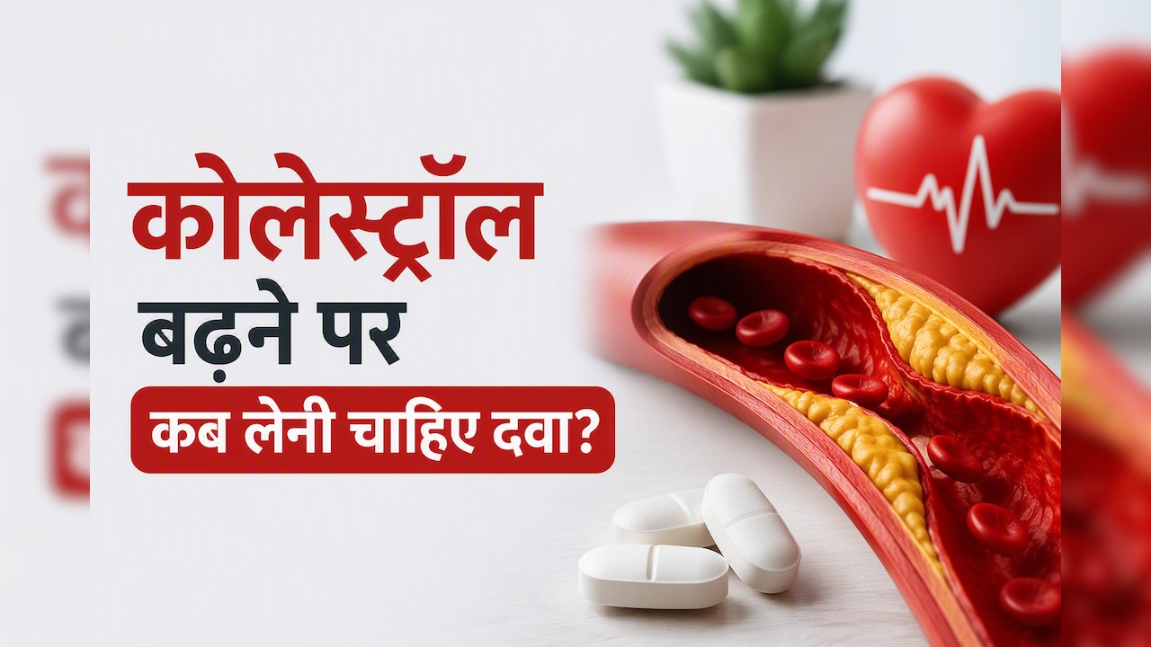 कोलेस्ट्रॉल कितना होने पर पड़ती है दवा की जरूरत? डॉक्टर से समझिए कब सिर्फ लाइफस्टाइल बदलाव से बन सकती है बात