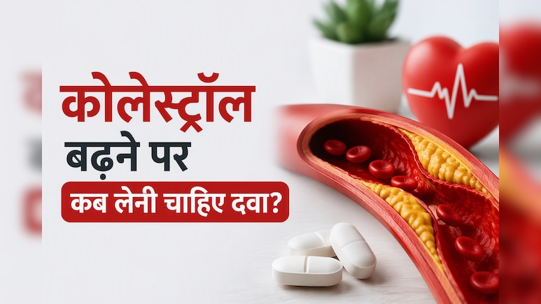 कोलेस्ट्रॉल कितना होने पर पड़ती है दवा की जरूरत? डॉक्टर से समझिए कब सिर्फ लाइफस्टाइल बदलाव से बन सकती है बात