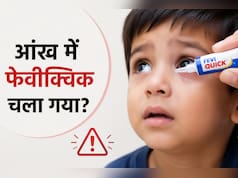 बच्चे की आंख में गलती से Feviquick चला जाए तो क्या करें? डॉक्टर ने बताया तुरंत उठाएं ये कदम