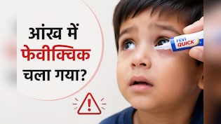 बच्चे की आंख में गलती से Feviquick चला जाए तो क्या करें? डॉक्टर ने बताया तुरंत उठाएं ये कदम