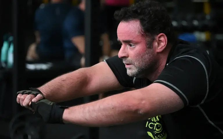 A rare genetic skin disorder effects a Spaniard who is unable to sweat