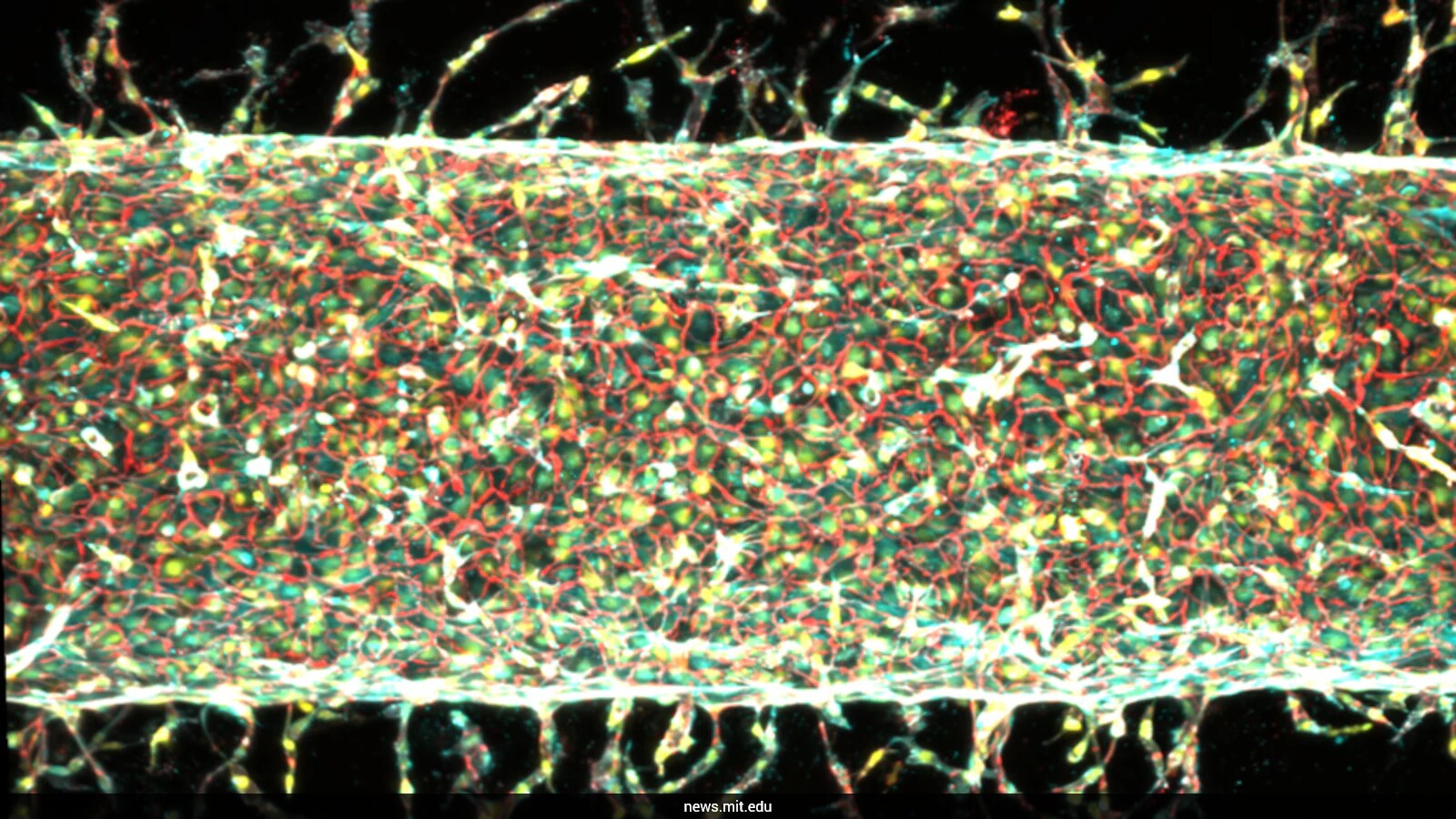 Magnetic Forces Guide Lab-Grown Blood Vessel Growth